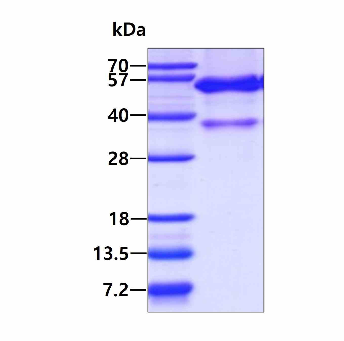 3 μg by SDS-PAGE under reducing condition and visualized by coomassie blue stain.